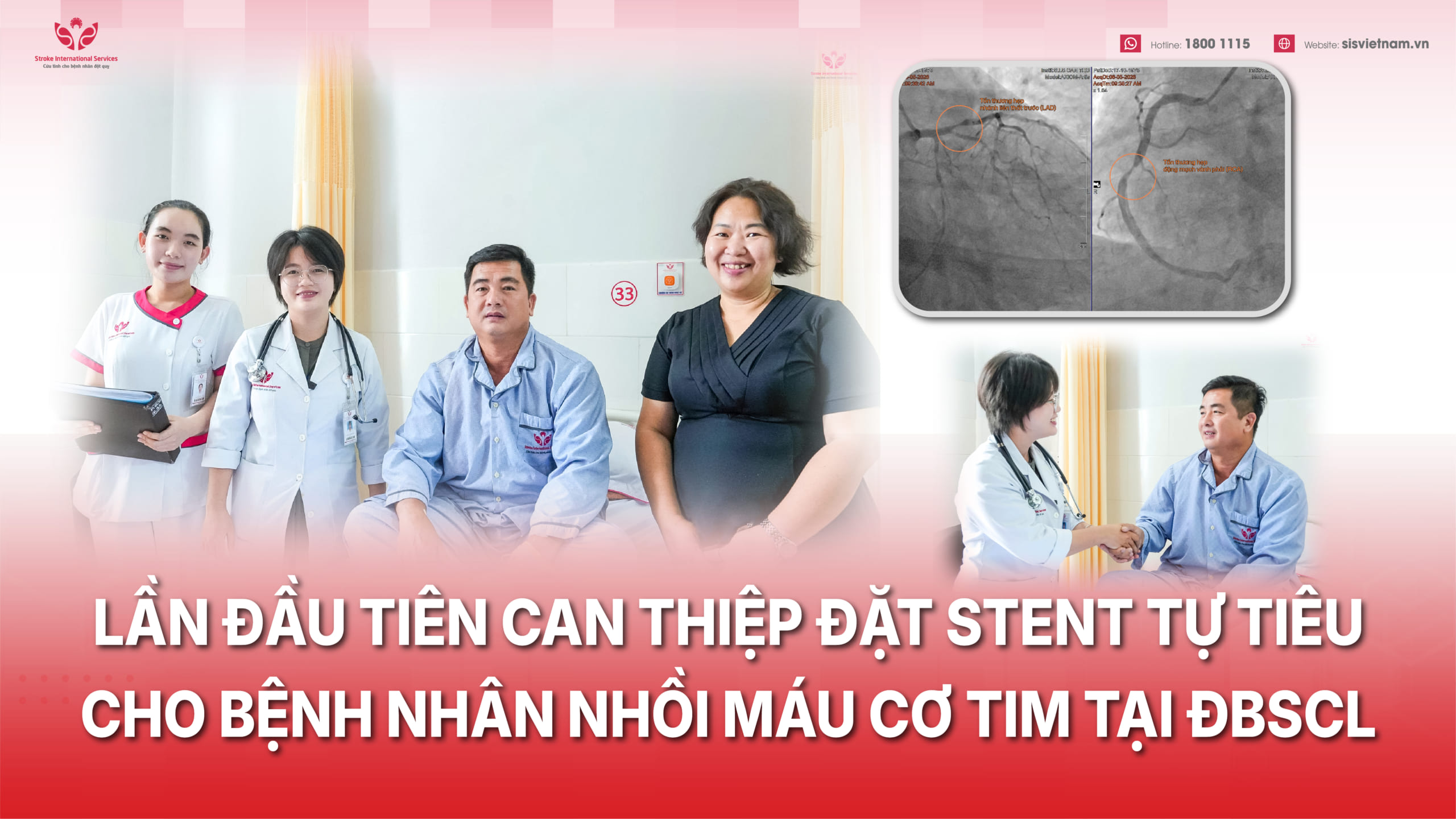 Đặt stent tự tiêu